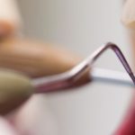 Periodoncia en Terrassa 2
