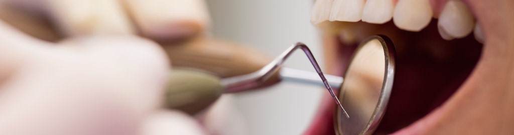 Tratamiento de periodoncia en Terrassa