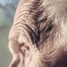 alzheimer y periodontitis