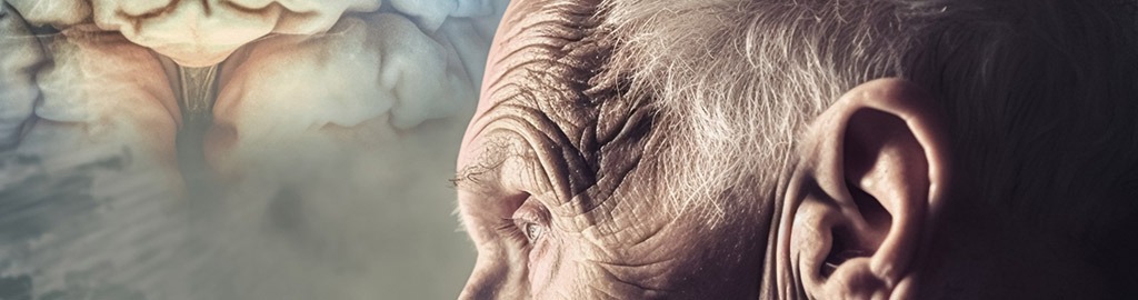 El Alzheimer revelado en el dentista: la clave está en la salud bucal