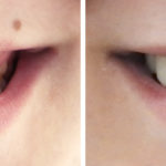 estética dental en Terrassa
