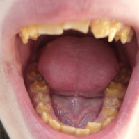 estética dental en Terrassa
