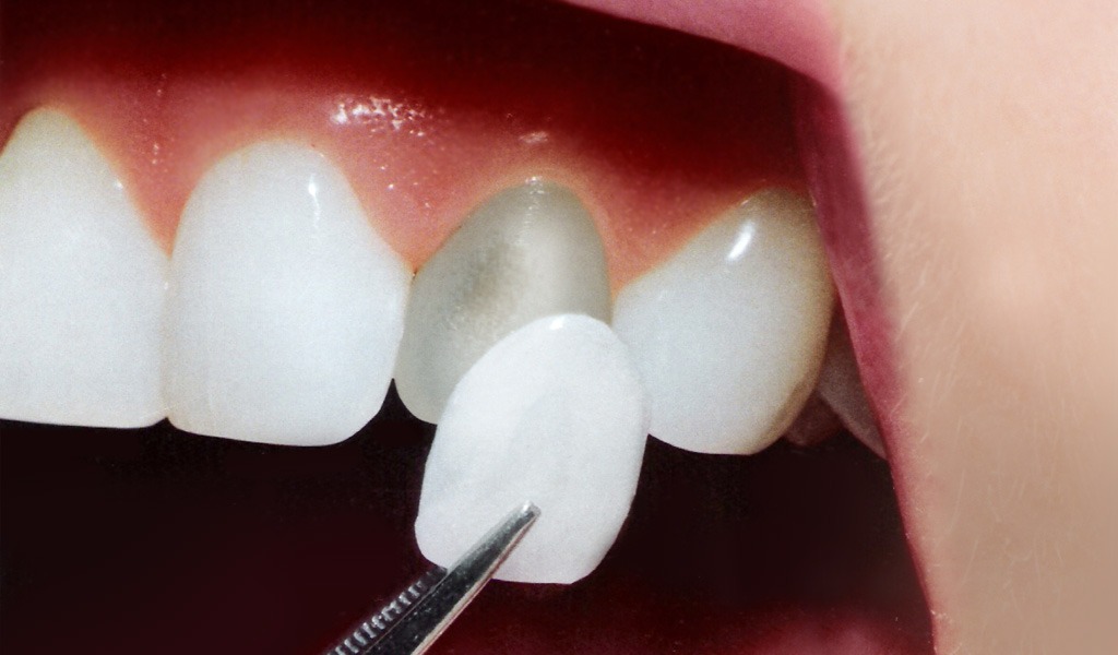Formación estética dental