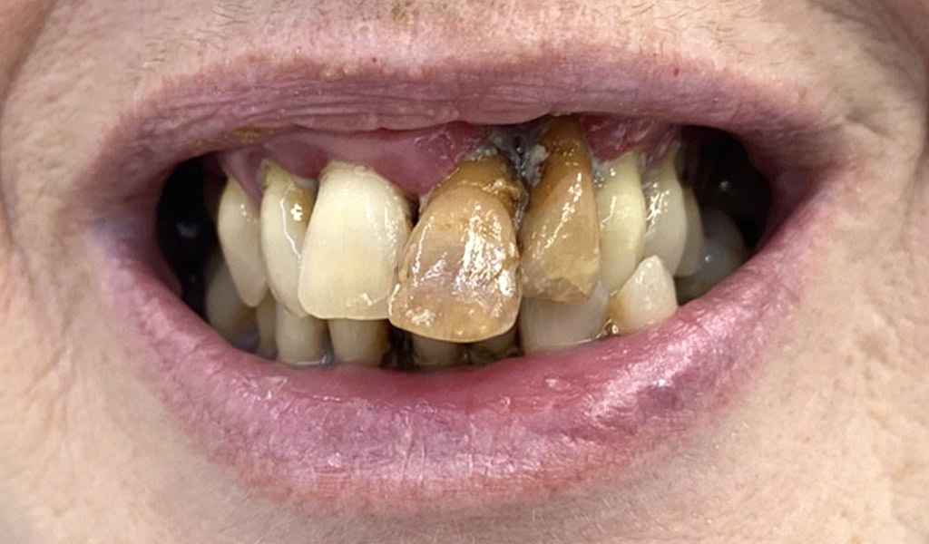 caso real de rehabilitación dental