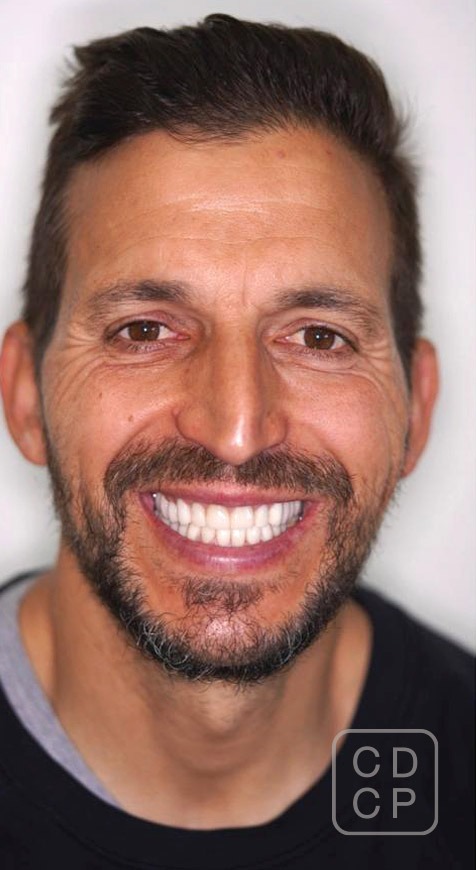 caso real de rehabilitación dental