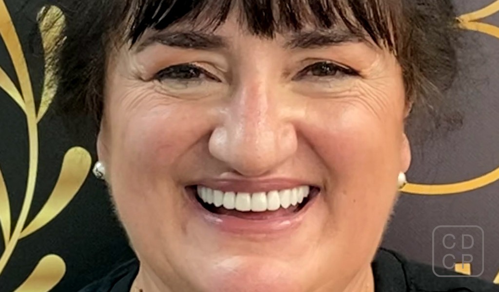 caso real de estética dental