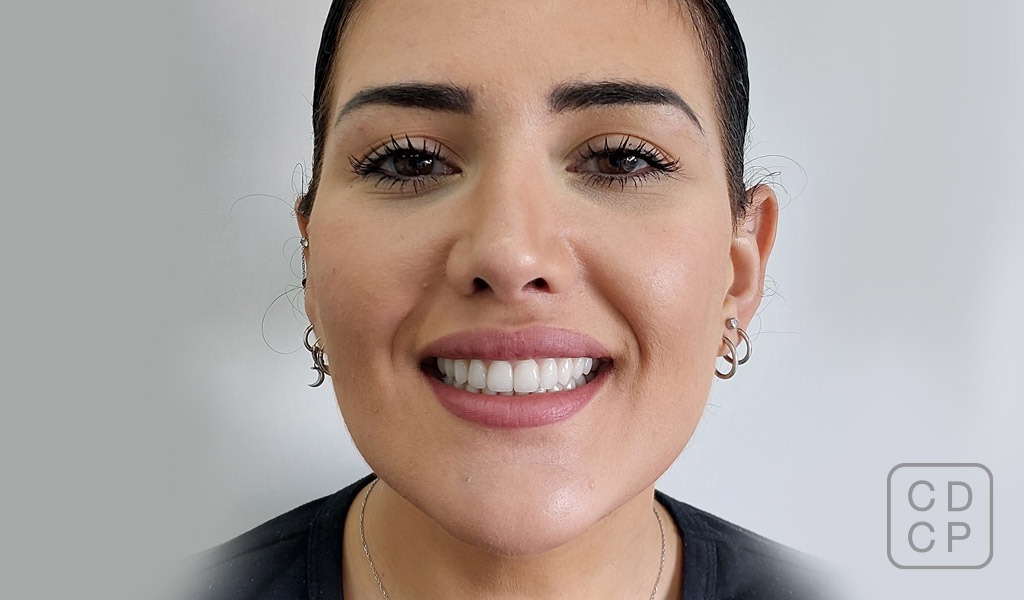 caso real de rehabilitación dental caso real de rehabilitación dental