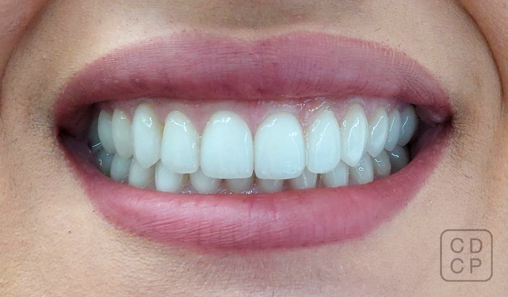 caso real de rehabilitación dental caso real de rehabilitación dental
