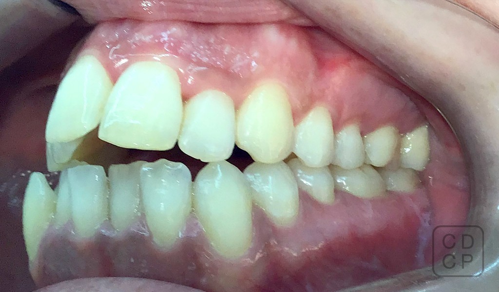 caso real de rehabilitación dental