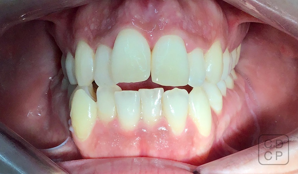 caso real de rehabilitación dental