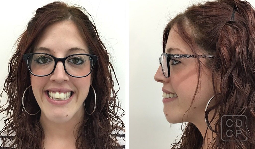 caso real de rehabilitación dental