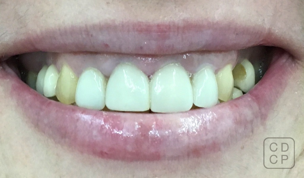 caso real de rehabilitación dental