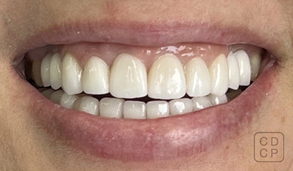 caso real de rehabilitación dental