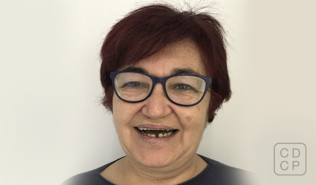 caso real de rehabilitación dental