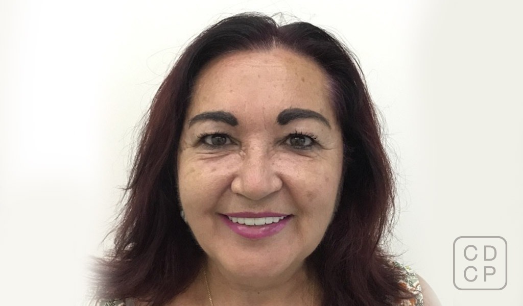 caso real de rehabilitación dental