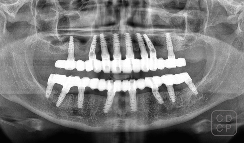caso real de rehabilitación dental
