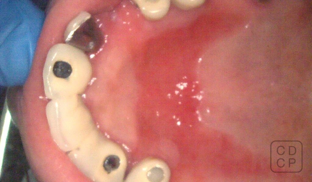 caso real de rehabilitación dental