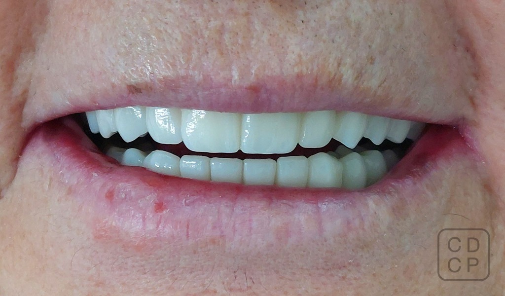 caso real de rehabilitación dental