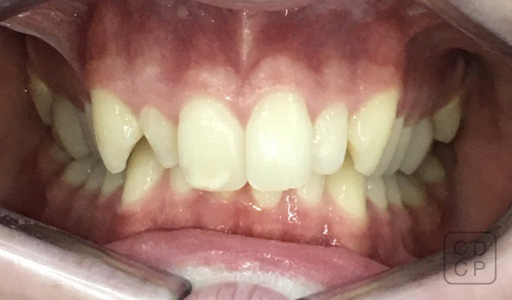 caso real de rehabilitación dental caso real de rehabilitación dental