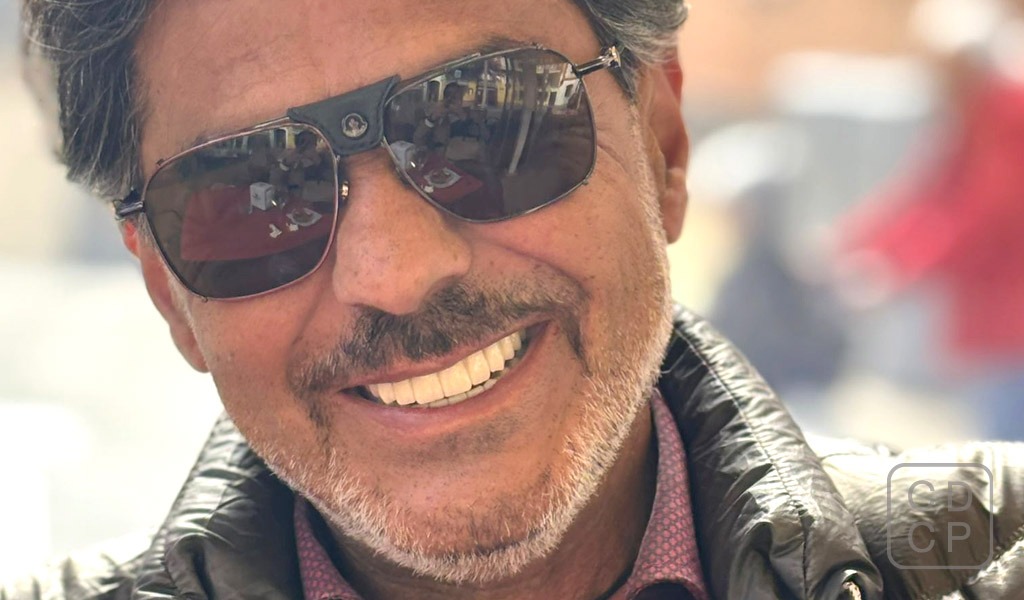caso real con implantes dentales