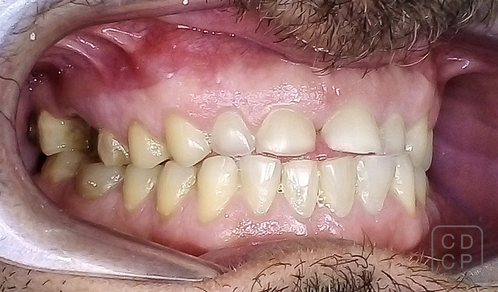 caso real de rehabilitación dental
