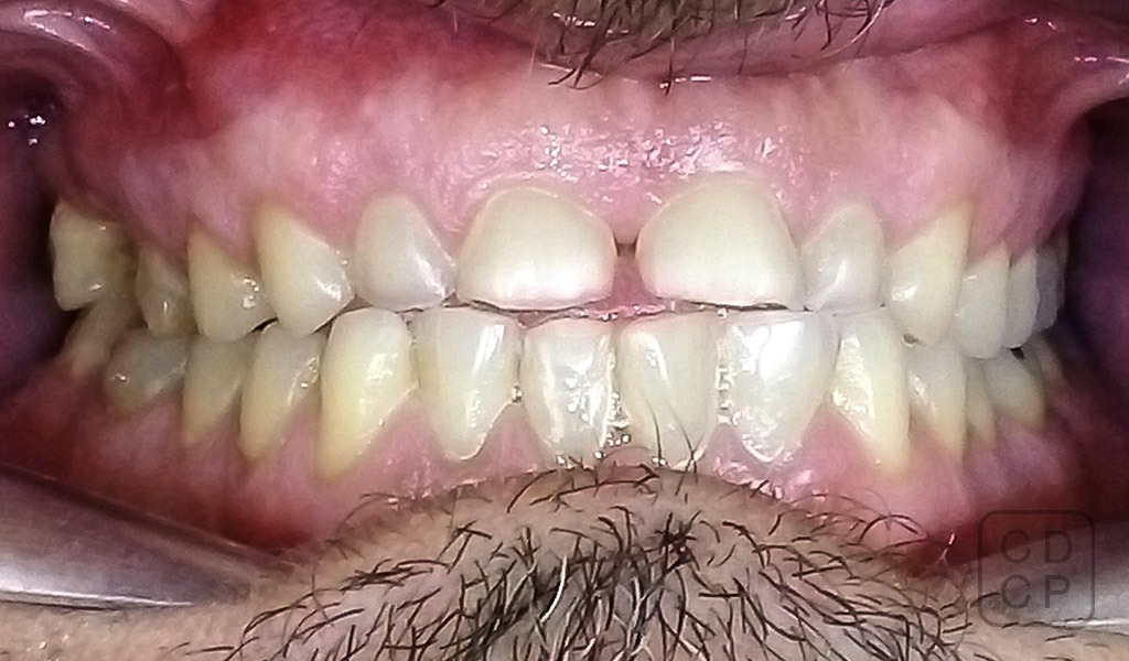 caso real de rehabilitación dental