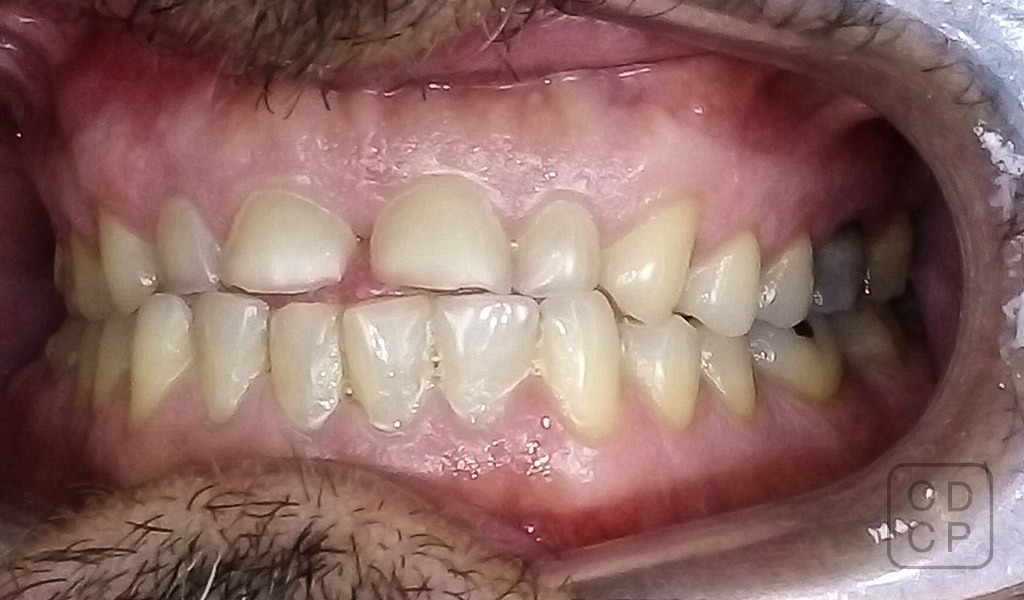 caso real de rehabilitación dental