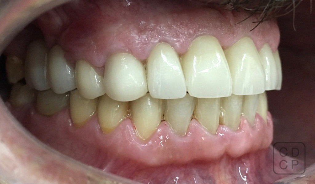 caso real de rehabilitación dental