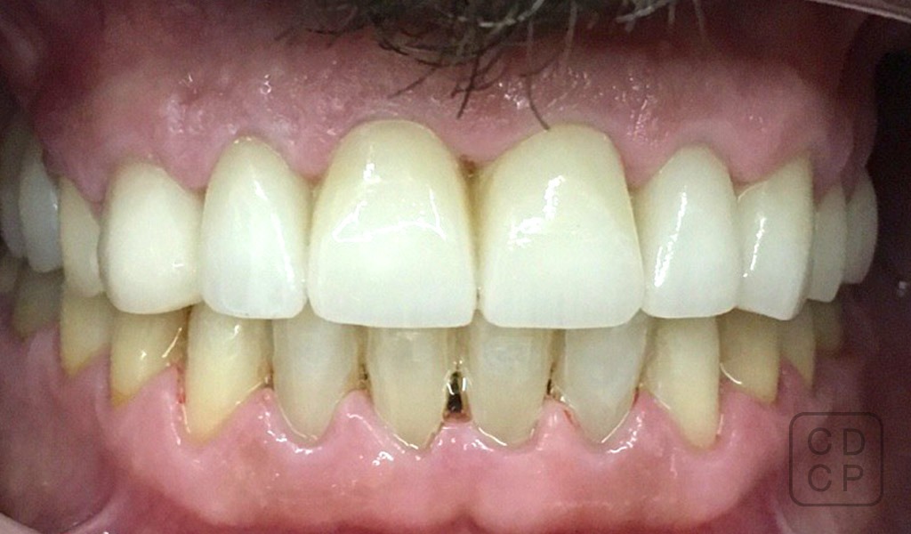 caso real de rehabilitación dental