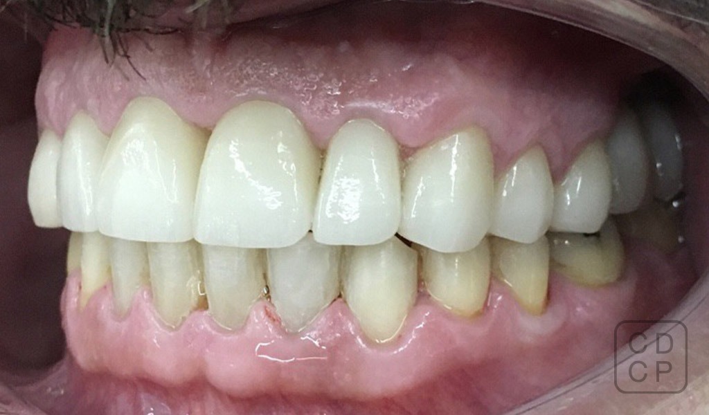 caso real de rehabilitación dental