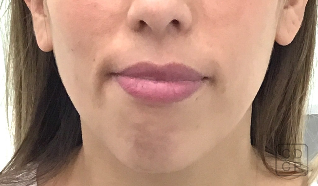 caso real de rehabilitación dental caso real de rehabilitación dental