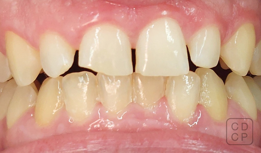 caso real de rehabilitación dental