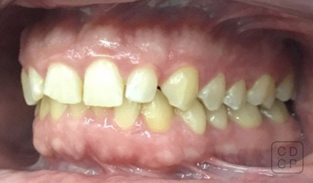 caso real de rehabilitación dental