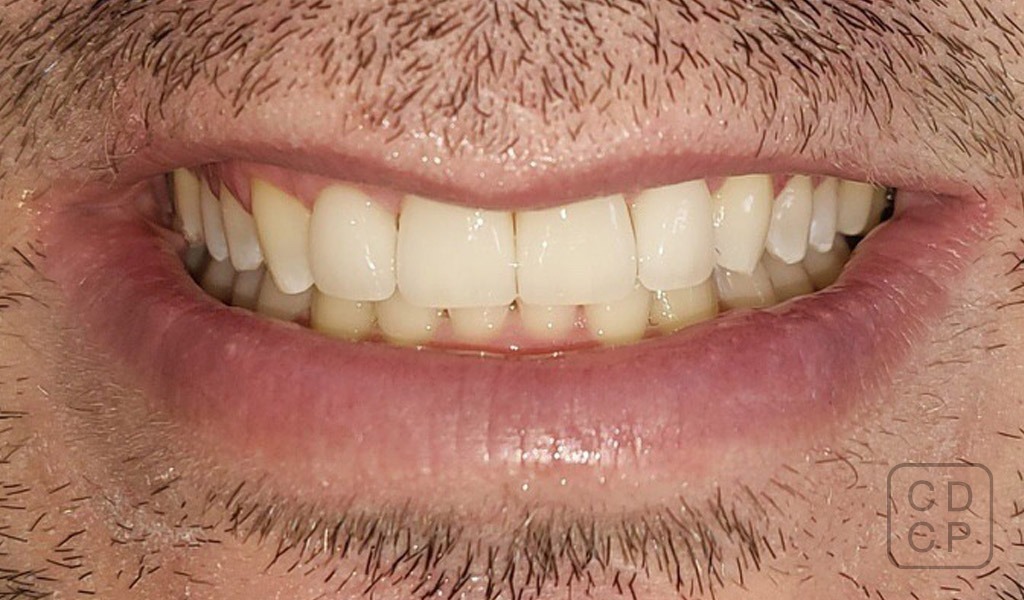 caso real de rehabilitación dental