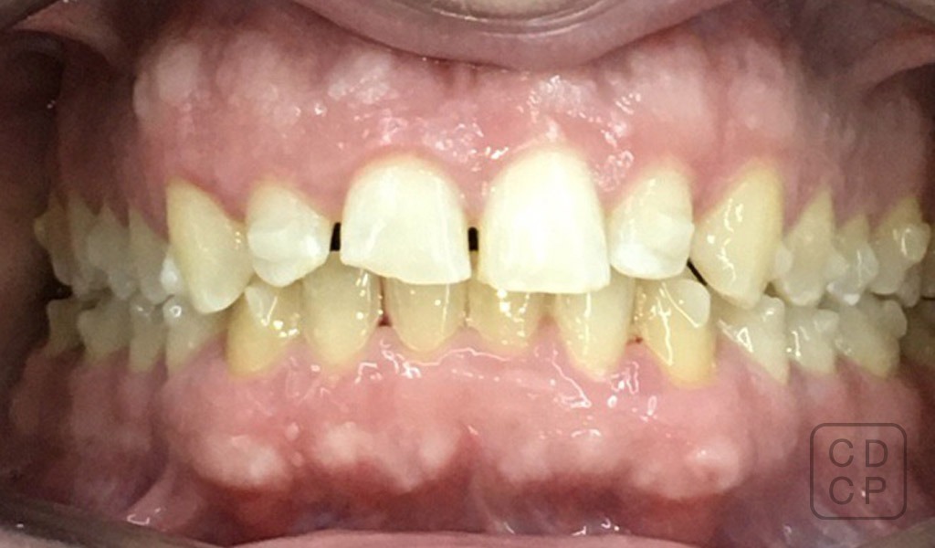 caso real de rehabilitación dental