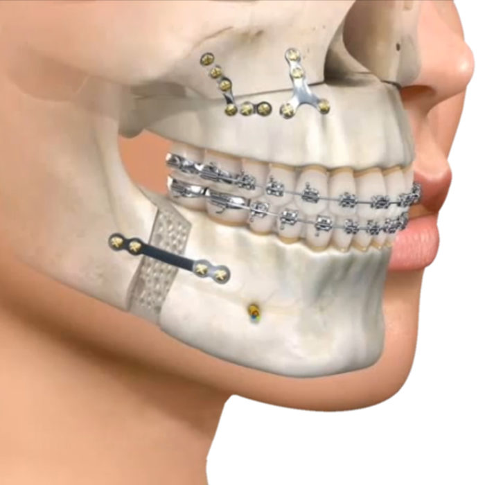 cirugía maxilofacial en Terrassa