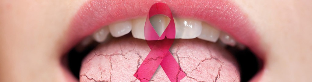 Efectos secundarios del tratamiento contra el cáncer en nuestra boca