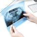¿Endodoncia o extracción dental?