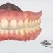 Escáner intraoral 3D en Terrassa
