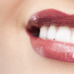 estética dental en Terrassa