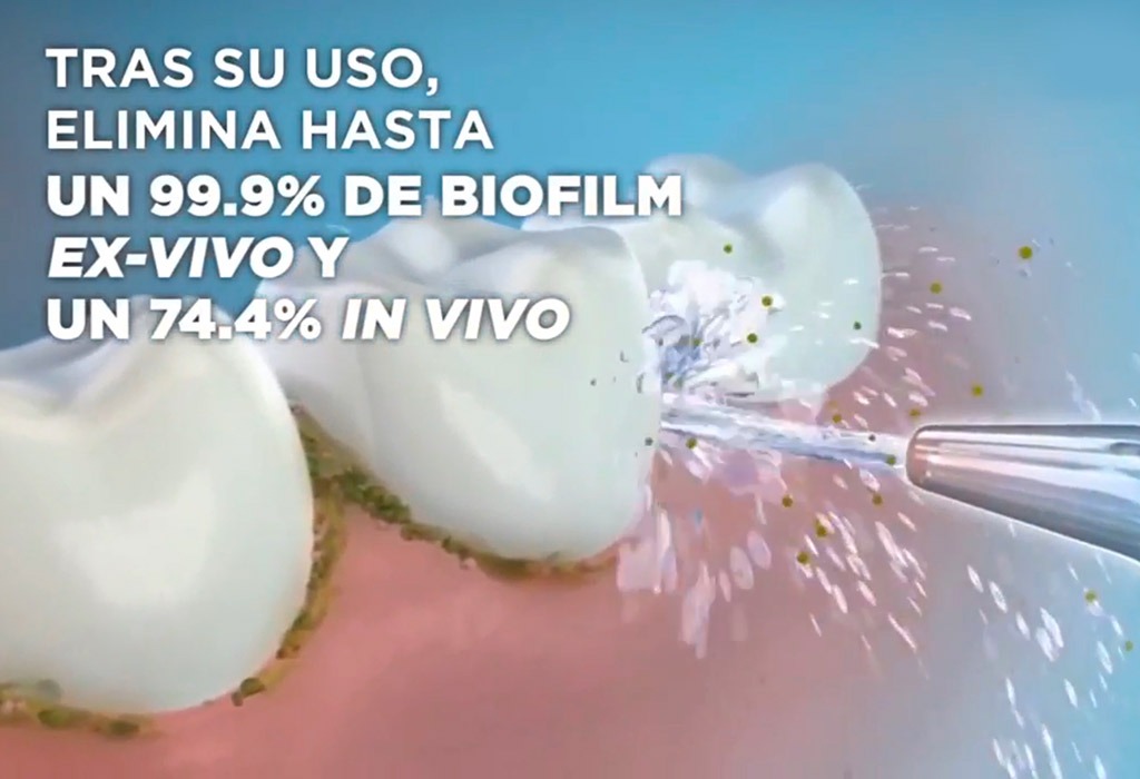 Formación sobre irridador oral Waterpick