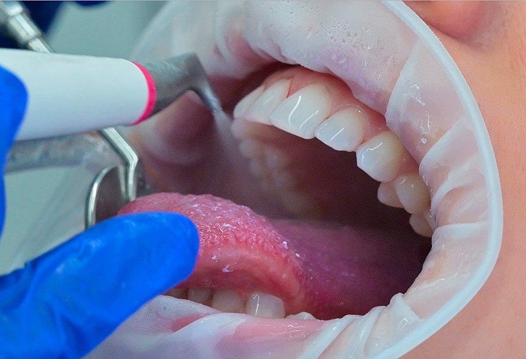 bioflow higiene dental con airflow