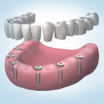 clínica dental en Rubí