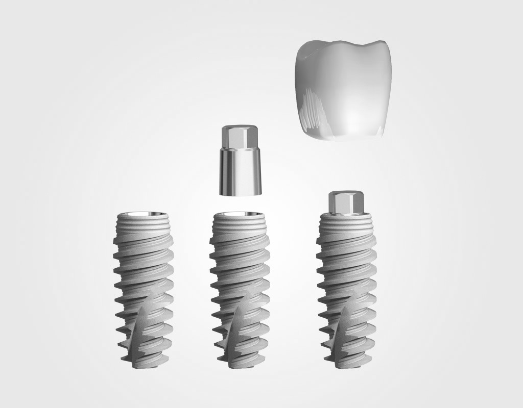 implantes dentales en Terrassa