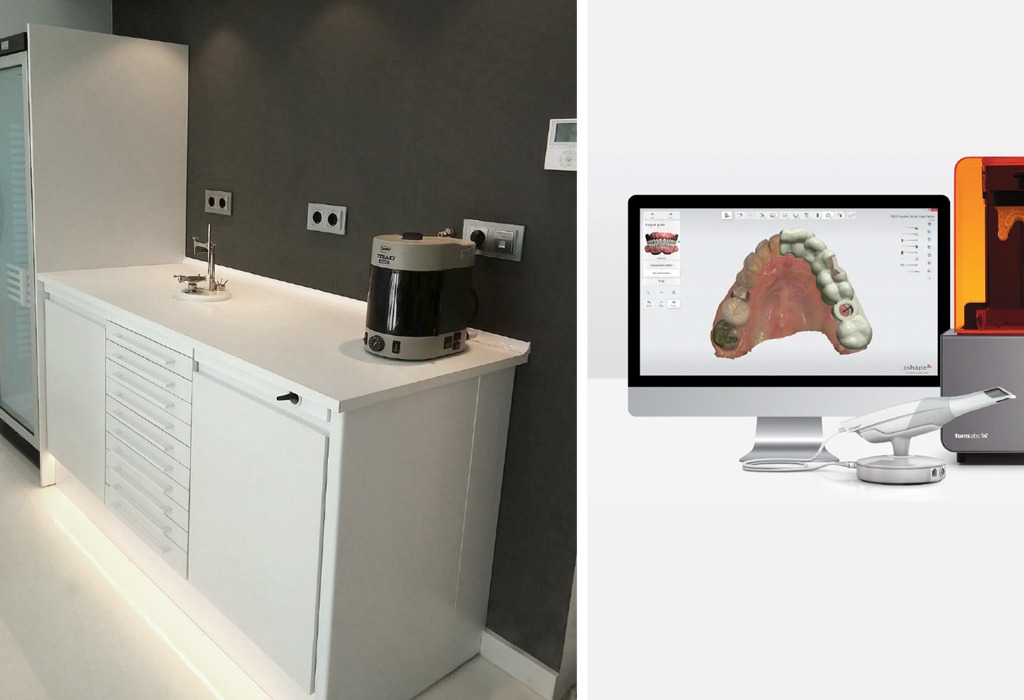 área de prótesis dental en Terrassa