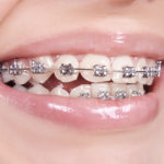 clínica dental en Rubí