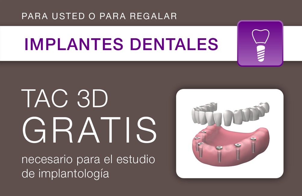 promoción TAC 3D gratis para implantología