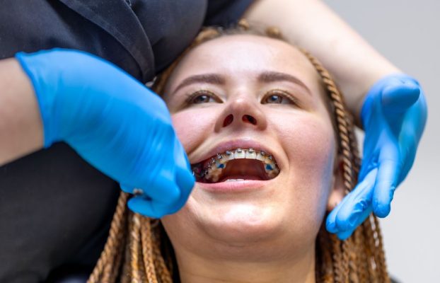 Urgencia dental con brackets: Guía completa de soluciones rápidas y efectivas