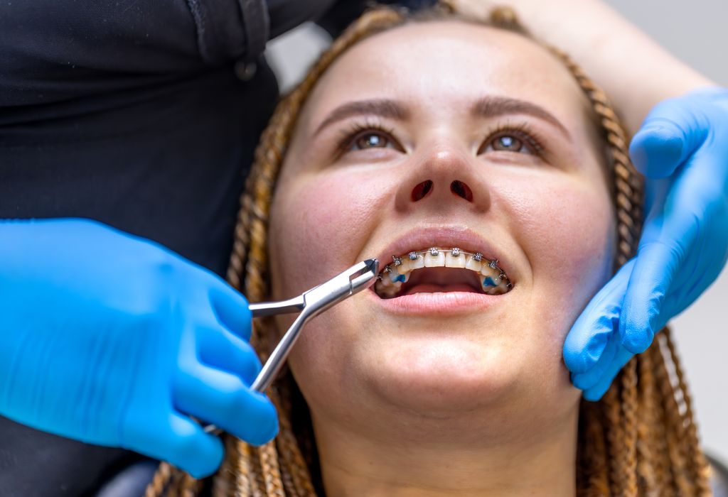 Urgencia dental con brackets