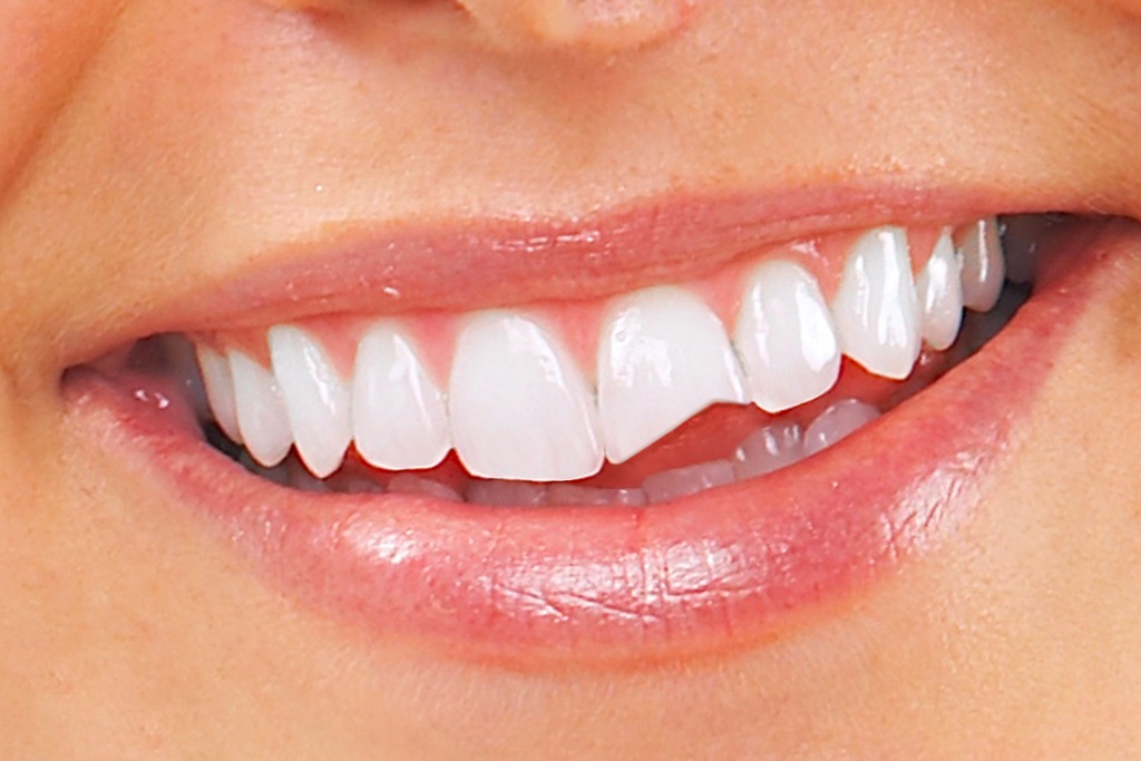 urgencias clínica dental en Terrassa